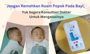 Jangan Remehkan Ruam Popok Pada Bayi, Yuk Segera Konsultasi Dokter Untuk Mengatasinya 1